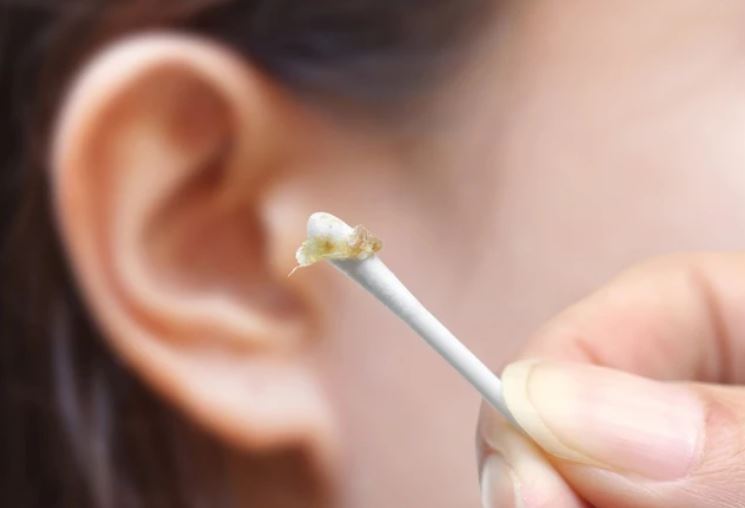 Sự thật ít biết về ráy tai - 'vệ sĩ thầm lặng' của cơ thể