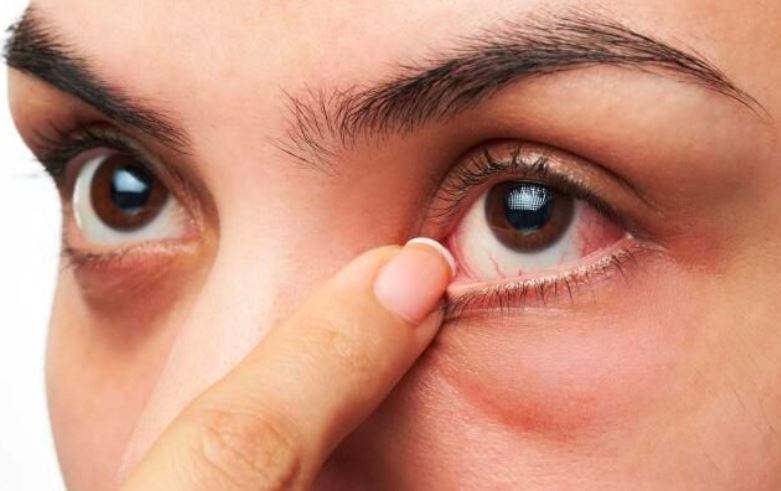 Cảnh báo từ chuyên gia: Hai dấu hiệu ngứa tưởng chừng vô hại lại là tín hiệu cảnh báo ung thư gan