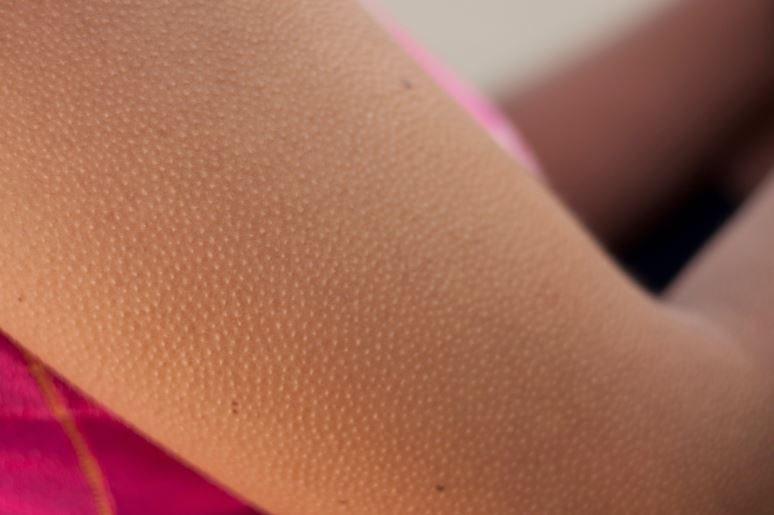 Lý giải nguyên nhân con người nổi da gà từ góc nhìn khoa học