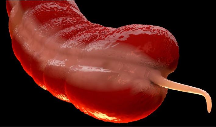 Một căn bệnh ung thư bị lãng quên đang gia tăng ở người trẻ khiến các chuyên gia bối rối