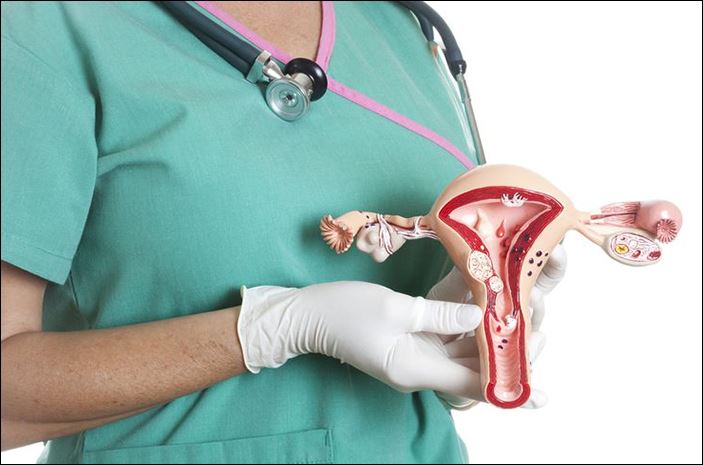 Cắt bỏ tử cung có thể làm tăng nguy cơ đột quỵ