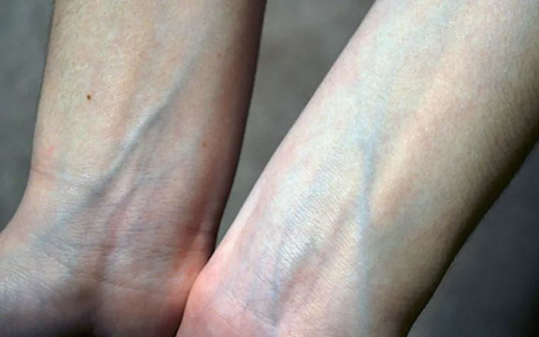 Vì sao máu luôn đỏ nhưng tĩnh mạch lại xanh?