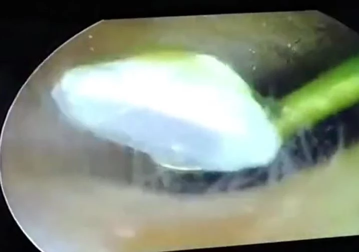 Ảnh cắt từ clip.