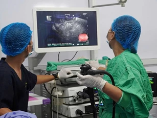 Đồng bằng sông Cửu Long lần đầu dùng stent LAMS điều trị nang giả tụy