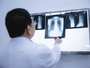 Đồng Nai đẩy nhanh ứng dụng AI khám chữa bệnh