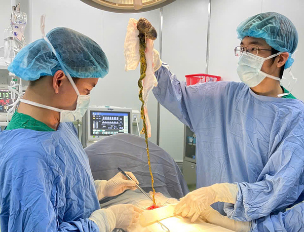 Trẻ em ăn tóc: Nguy cơ bệnh lý tiêu hoá nguy hiểm