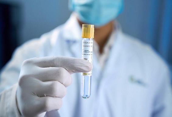 Xét nghiệm máu tầm soát đa ung thư SPOT-MAS 10 được FDA Hoa Kỳ công nhận