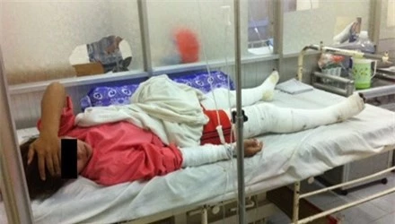 Nạn nhân đang điều trị tại khoa bỏng tạo hình, Bệnh viện Chợ Rẫy TPHCM. Ảnh: Quốc Ngọc/Tiền Phong