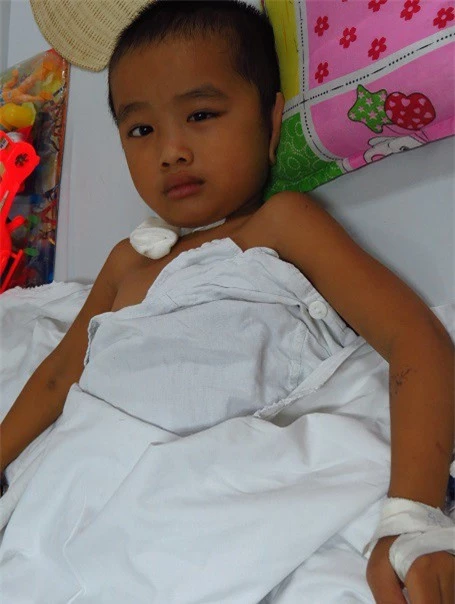 Bị tan nạn xe đá ngáng qua nên bé Lâm được chuyển từ bệnh viện tuyến tỉnh lên cấp cứu tại bệnh viện Việt Đức.