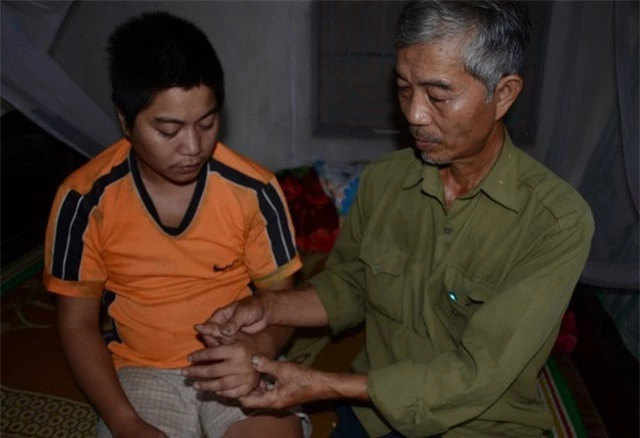 Đứa con thứ 2, Vũ Xuân Anh(33 tuôi), cũng bị phát bệnh tâm thần 4 năm nay, mỗi khi lên cơn thì anh lại chửi đánh bố mẹ, vợ con, đến nỗi người vợ phải đưa đứa con nhỏ bỏ về nhà ngoại.