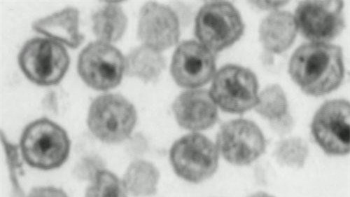 Chủng mới của virus HIV có thể là thách thức cho các xét nghiệm chẩn đoán