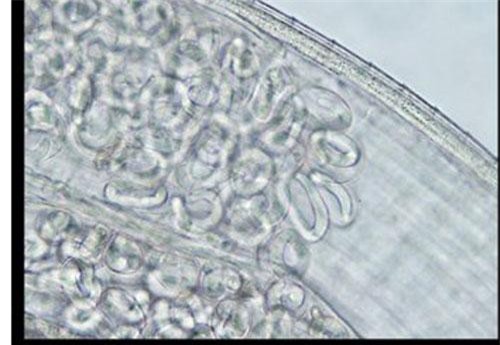 Kinh hoàng chuyện người phụ nữ bị nhiễm ký sinh trùng khi chạy ngang qua đàn ruồi