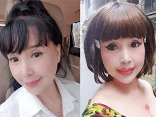 'Em bé Hà Nội' sau nhiều lần gay gắt chối bỏ đã bất ngờ thừa nhận có 'can thiệp' trên gương mặt