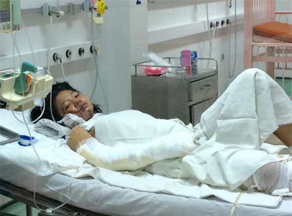 Bé gái bị mẹ tẩm xăng đốt: Con muốn được về với mẹ