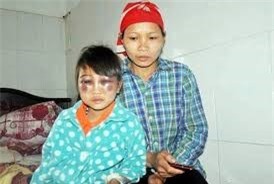 Cô giáo đánh học sinh tím mặt: Thông tin mới nhất