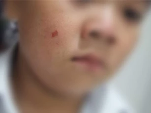 Con bị xước má, phụ huynh vào trường tát giáo viên