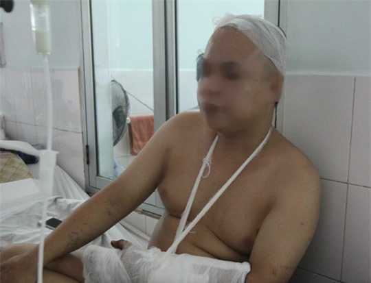 Đang uống nước mía, bị giang hồ đất Cảng chém bay 3 mảnh sọ