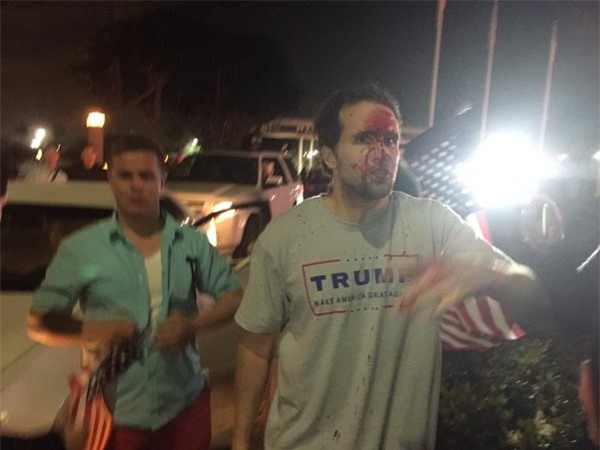 Donald Trump dính bê bối tình dục, dân Mỹ xuống phố biểu tình