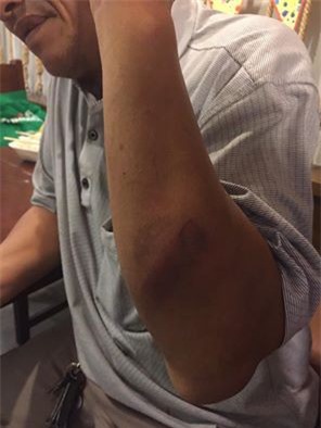 Hà Nội: Tài xế VIC taxi đánh hội đồng nhân viên bảo vệ vì bị ngăn đỗ xe trên vỉa hè