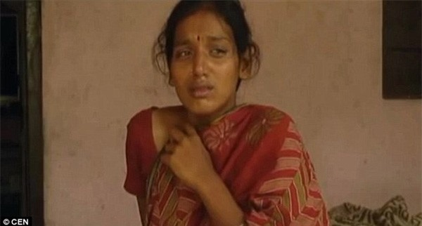 Mang thai bé gái, mẹ chồng tàn độc đổ axit lên bụng con dâu