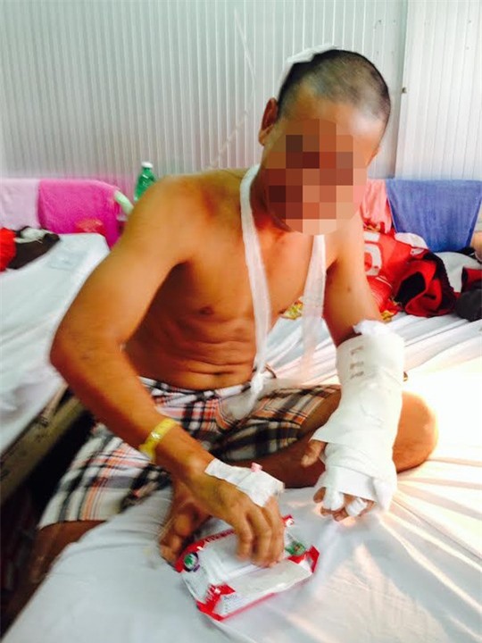 Nam thanh niên quê ở Trà Vinh bị anh họ chặt rớt bàn tay trái