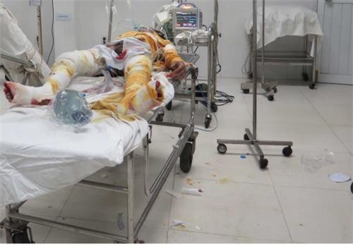 Nghi án chồng dùng xăng ôm vợ tự thiêu vì mâu thuẫn tình ái