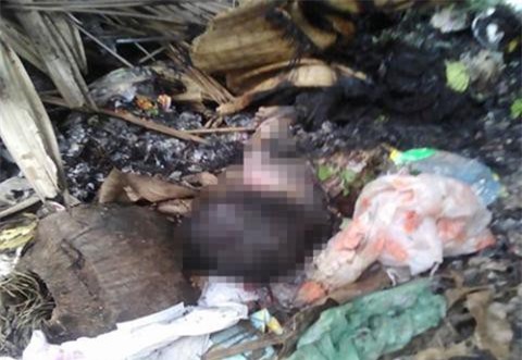 Quặn lòng bé sơ sinh bị mẹ ra tay tàn độc đốt ở Bến Tre