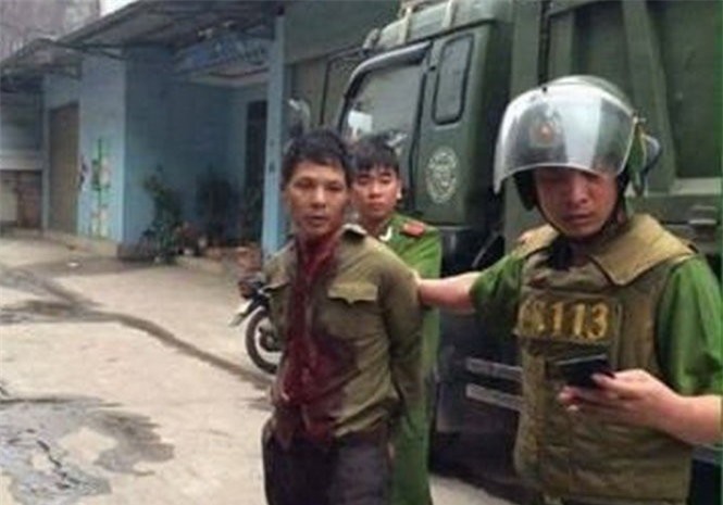 Thái Nguyên: Xin tiền không được, em trai nhẫn tâm chém rời tay chị gái