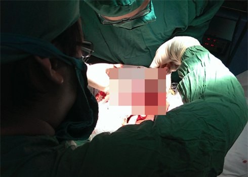 Thanh niên tự cắt đứt 'của quý' trong cơn ngáo đá