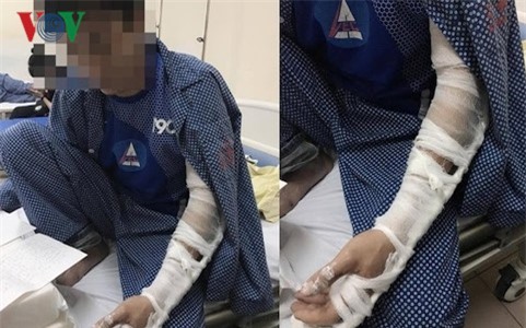 Tranh quảng cáo thông bể phốt, người đàn ông bị đánh nhập viện