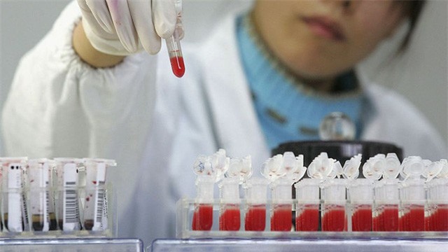 Xuất hiện người đầu tiên có thể chữa khỏi căn bệnh HIV