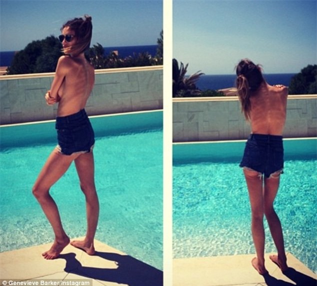 Đăng ảnh mình lên mạng, nữ người mẫu trẻ bị chê là "bộ xương di dộng'