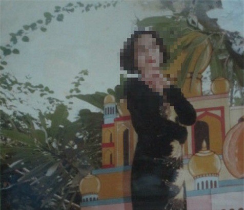 Nỗi đau cả gia đình bị hàng xóm tạt axit