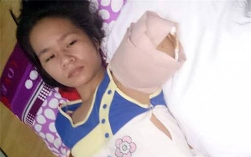 Nghệ An: Nữ du khách bị hổ cắn đứt cánh tay khi đi tham quan 