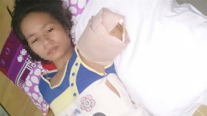 Hổ vồ đứt cánh tay: Nữ du khách kể lại phút sinh tử