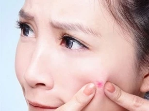 Nguy hiểm khi tự ý nặn nhọt: Một phụ nữ rơi vào trạng thái hôn mê