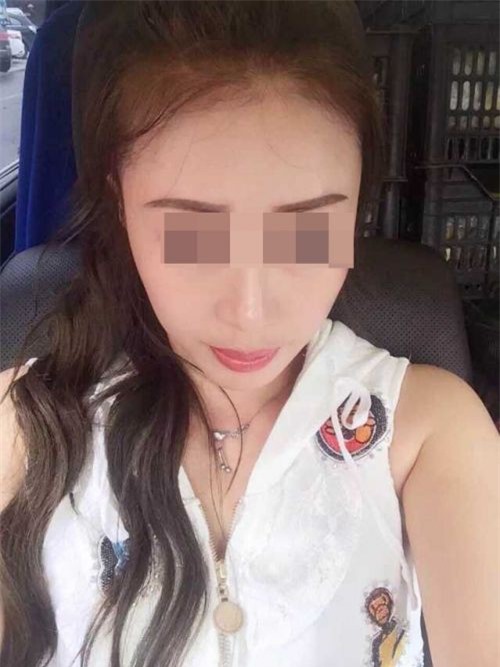 Mỹ nữ chết oan vì phẫu thuật ... “nơi thầm kín”