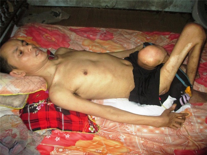 “Chồng liệt rồi, vợ còn đòi bán nhà làm chi ?!”