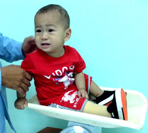 Bé trai văng khỏi bụng mẹ bắt đầu tập đứng bằng chân giả