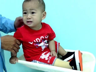 Bé trai văng khỏi bụng mẹ bắt đầu tập đứng bằng chân giả