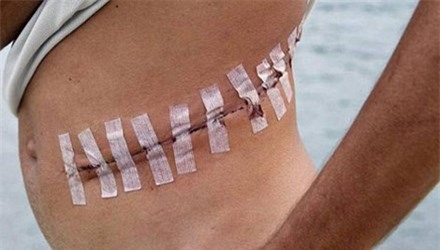 Đột nhập trạm kinh doanh nội tạng người của phiến quân IS