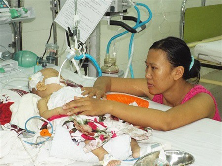 Bé 6 tháng tuổi nguy kịch vì viêm phổi, tim bẩm sinh