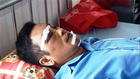 Kéo côn đồ đến chém bạn trai của vợ cũ vì ghen tuông