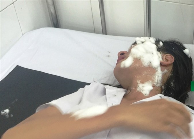 Điểm lại những vụ trả thù tình bằng axit