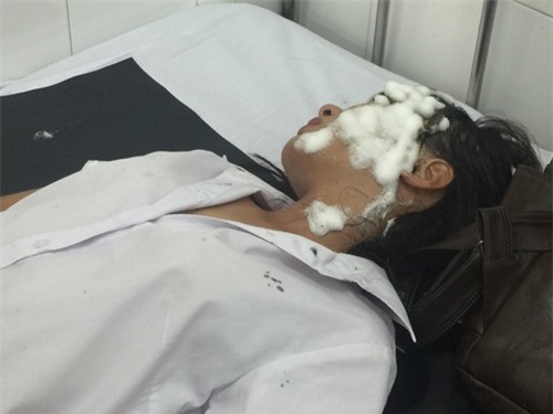 Vụ tạt axit hai nữ sinh: Đã bắt được nghi can