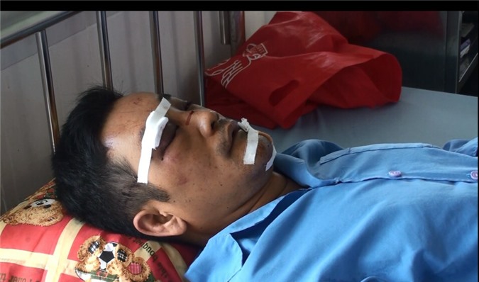 Đến nhà bạn chơi, bị côn đồ chém trọng thương