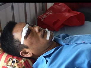 Đến nhà bạn chơi, bị côn đồ chém trọng thương