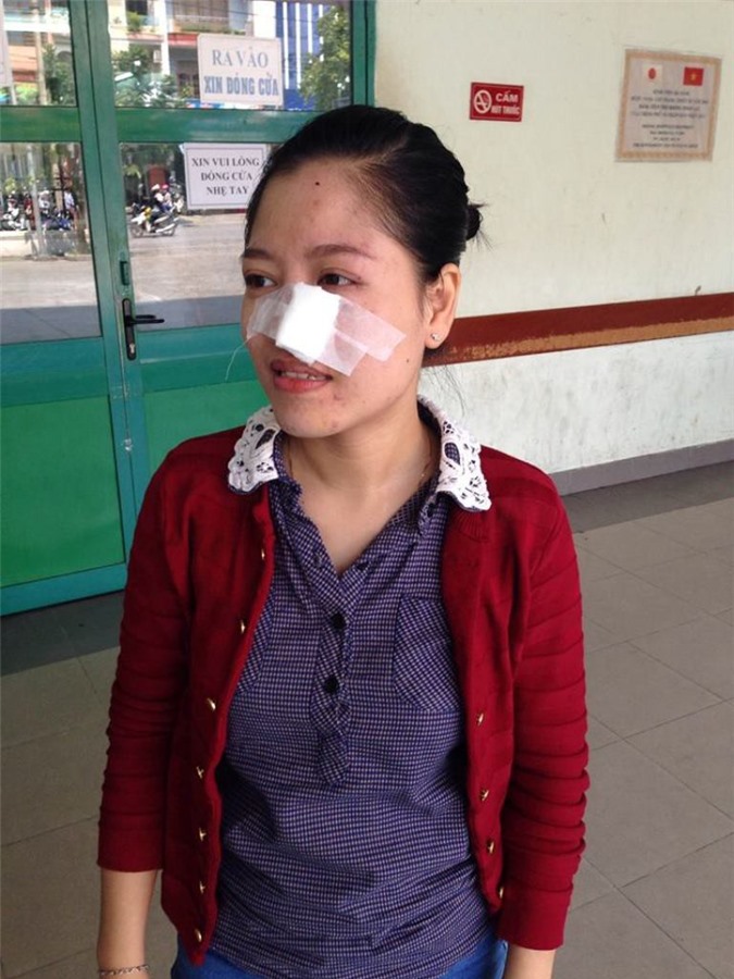 Nữ du khách bị khỉ tấn công trên bán đảo Sơn Trà 