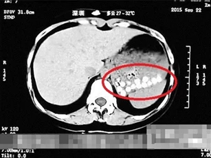 Hoảng hồn phát hiện trà sữa trân châu làm từ… đế giày và lốp cao su