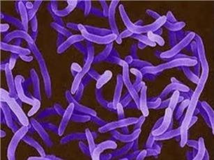 Việt Nam đứng trước nguy cơ lây nhiễm bệnh bạch hầu